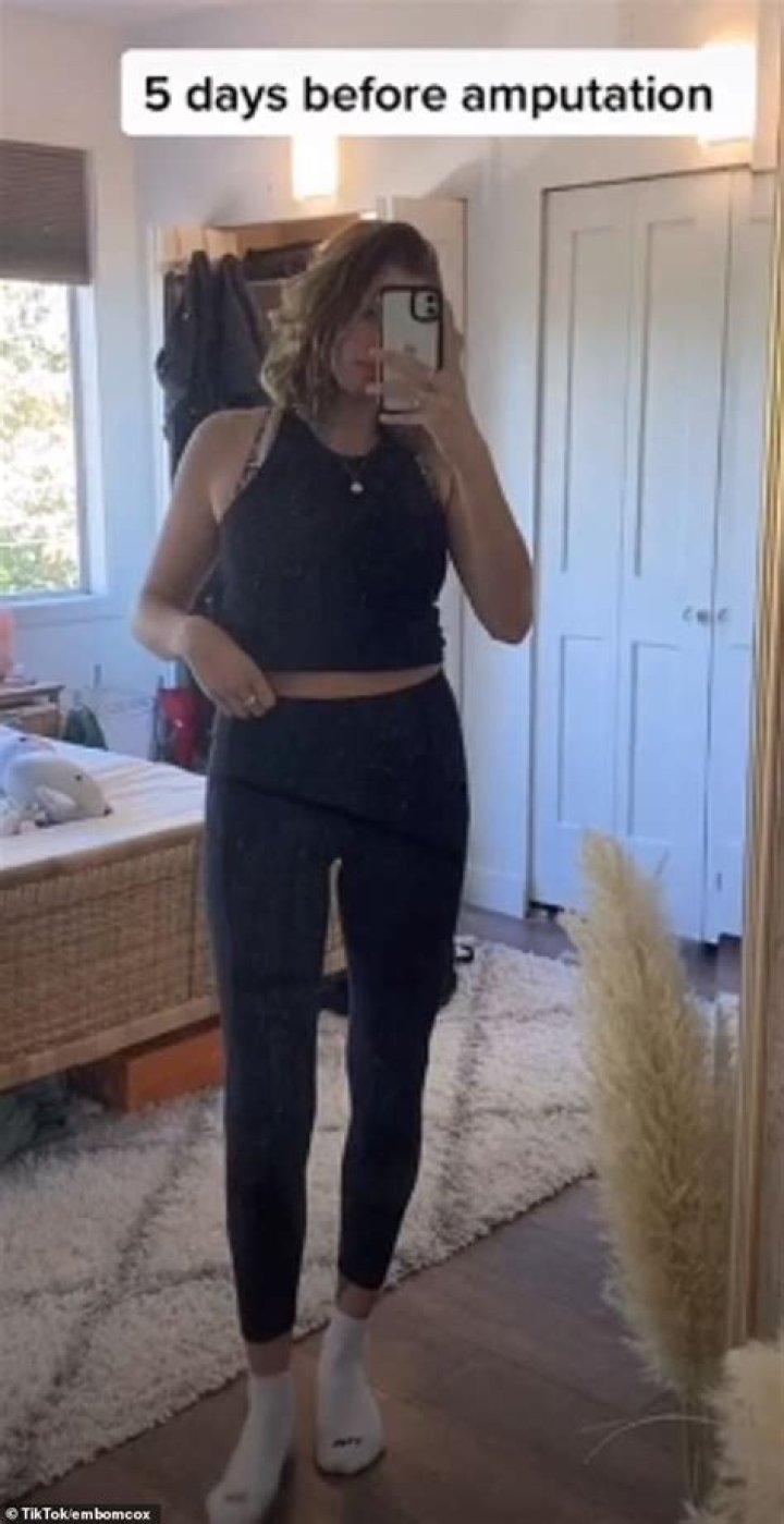 Countdown: Emily Cox, 24, gamely documented the before and after in a viral TikTok video that has earned abut 40 million views
